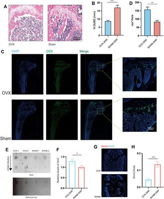 Mechanisms of estrogen deficiency-induced osteoporosis based on transcriptome and DNA methylation